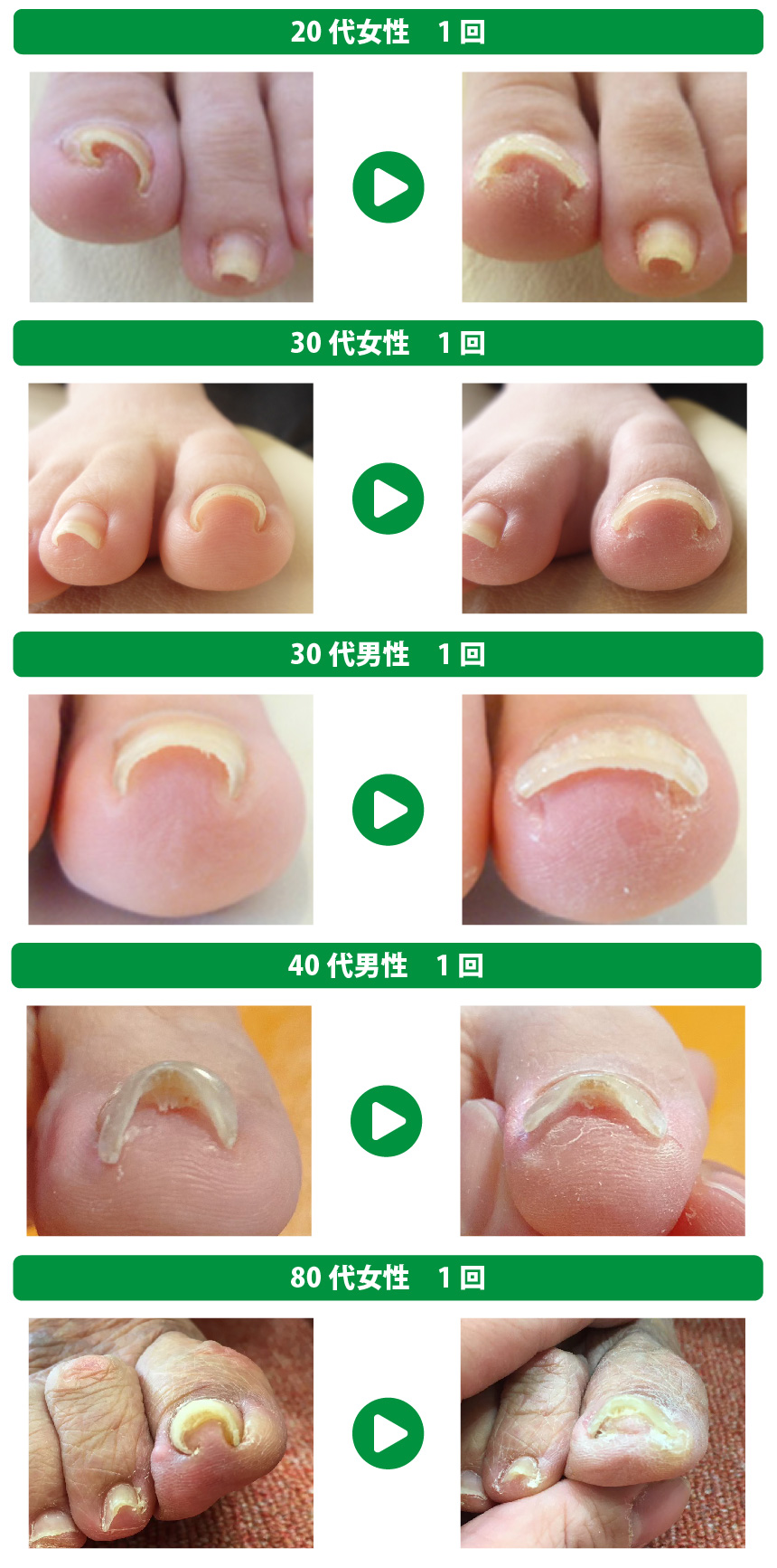ビフォーアフター