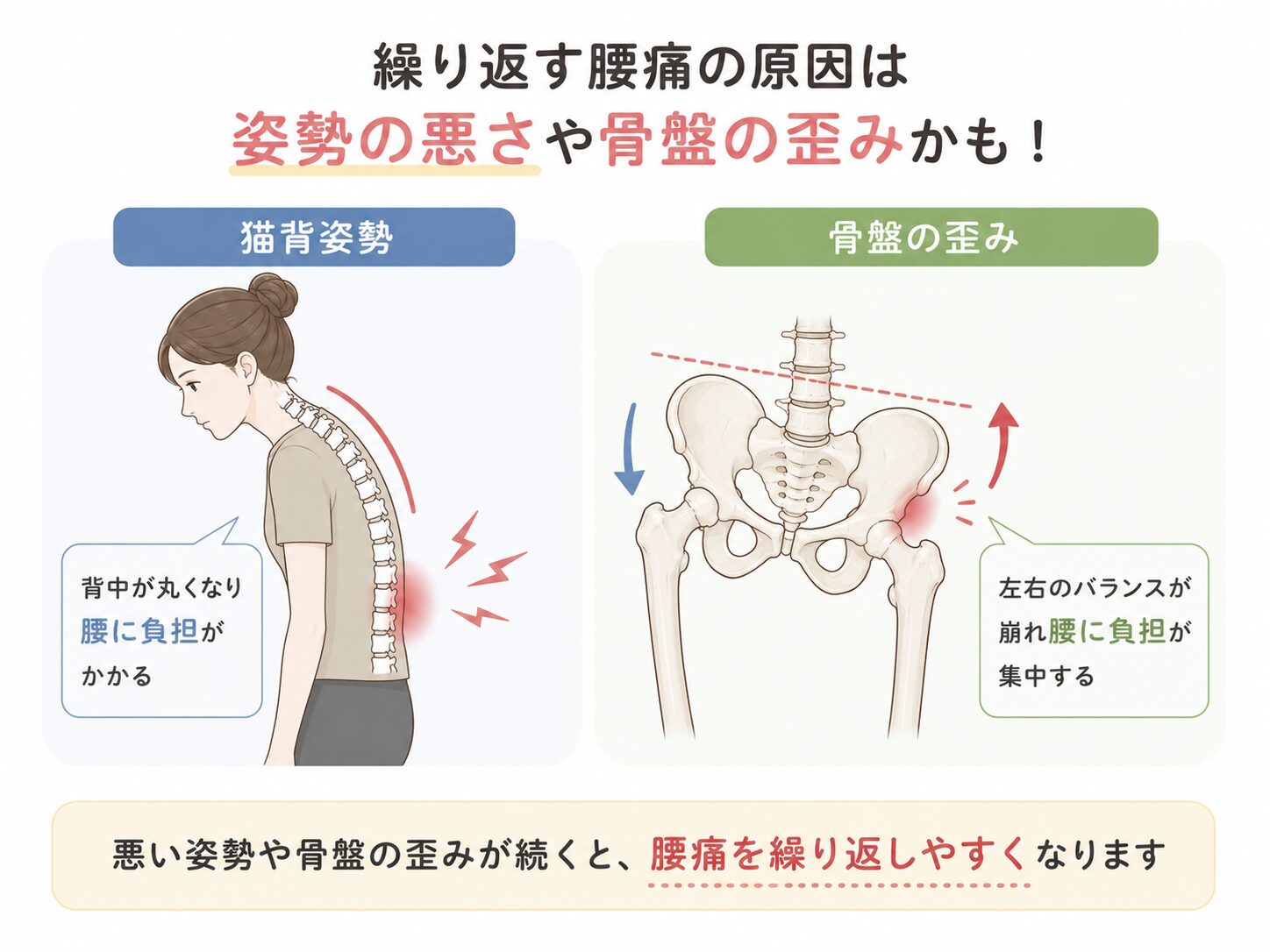 腰痛の原因となる姿勢不良のイメージ|長浜市